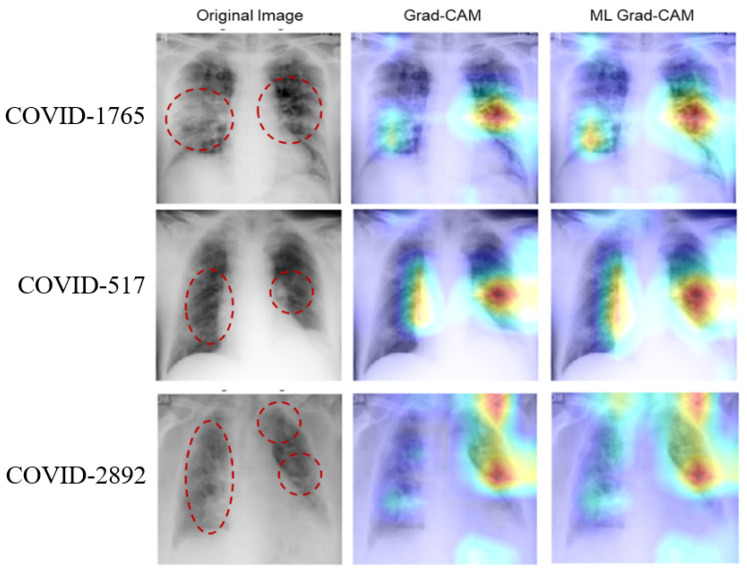 AI-annotated scan heatmap